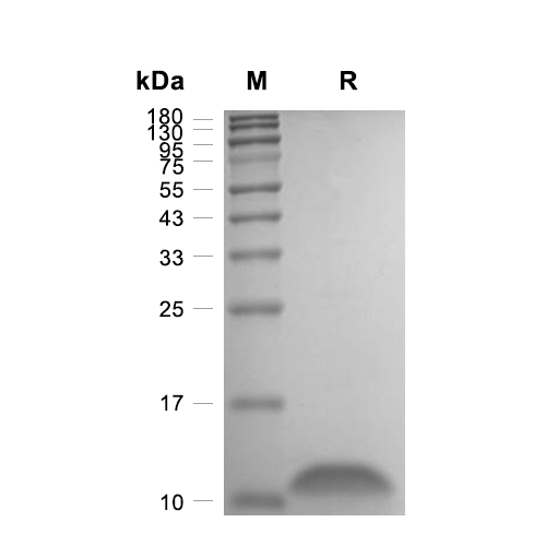 SAA1/Serum Amyloid A-1蛋白, Mouse (His),SAA1/Serum Amyloid A-1 Protein, Mouse (His)
