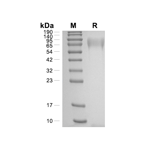 TPO/Thrombopoietin蛋白, Human (HEK293, C-His),TPO/Thrombopoietin Protein, Human (HEK293, C-His)