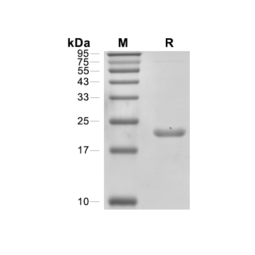 IL-6蛋白, Mouse (His),IL-6 Protein, Mouse (His)