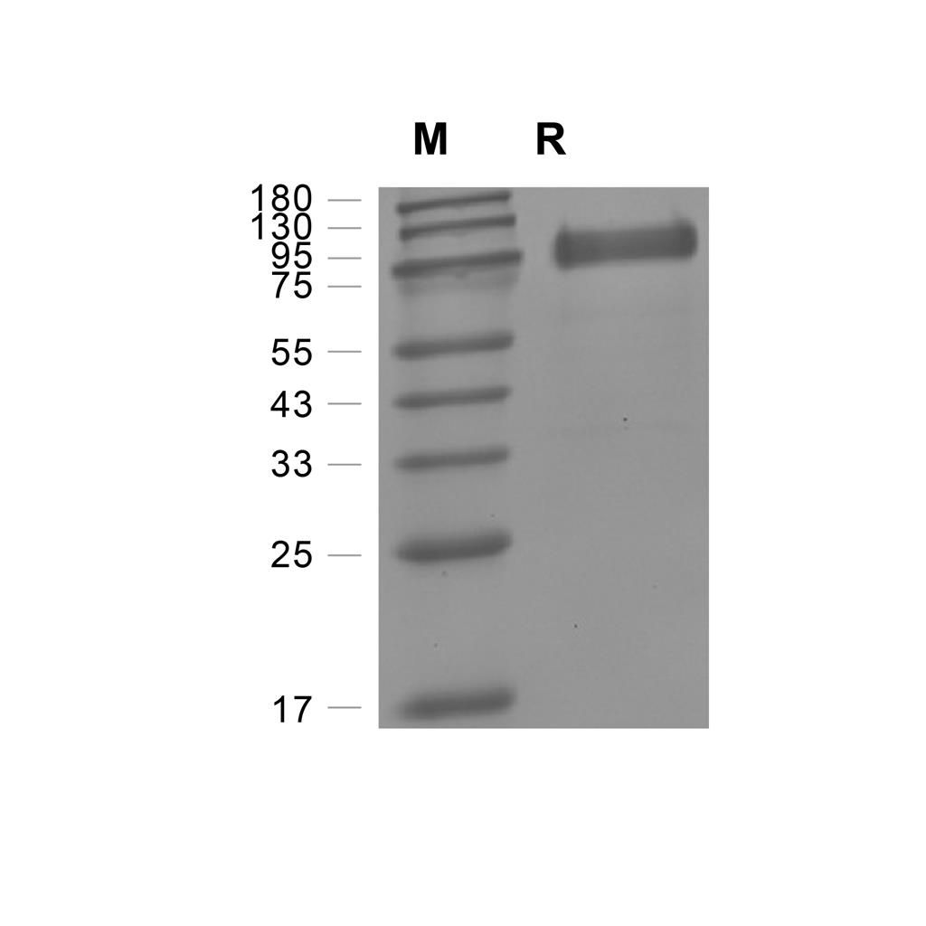 Prothrombin蛋白, Human (HEK293, His),Prothrombin Protein, Human (HEK293, His)