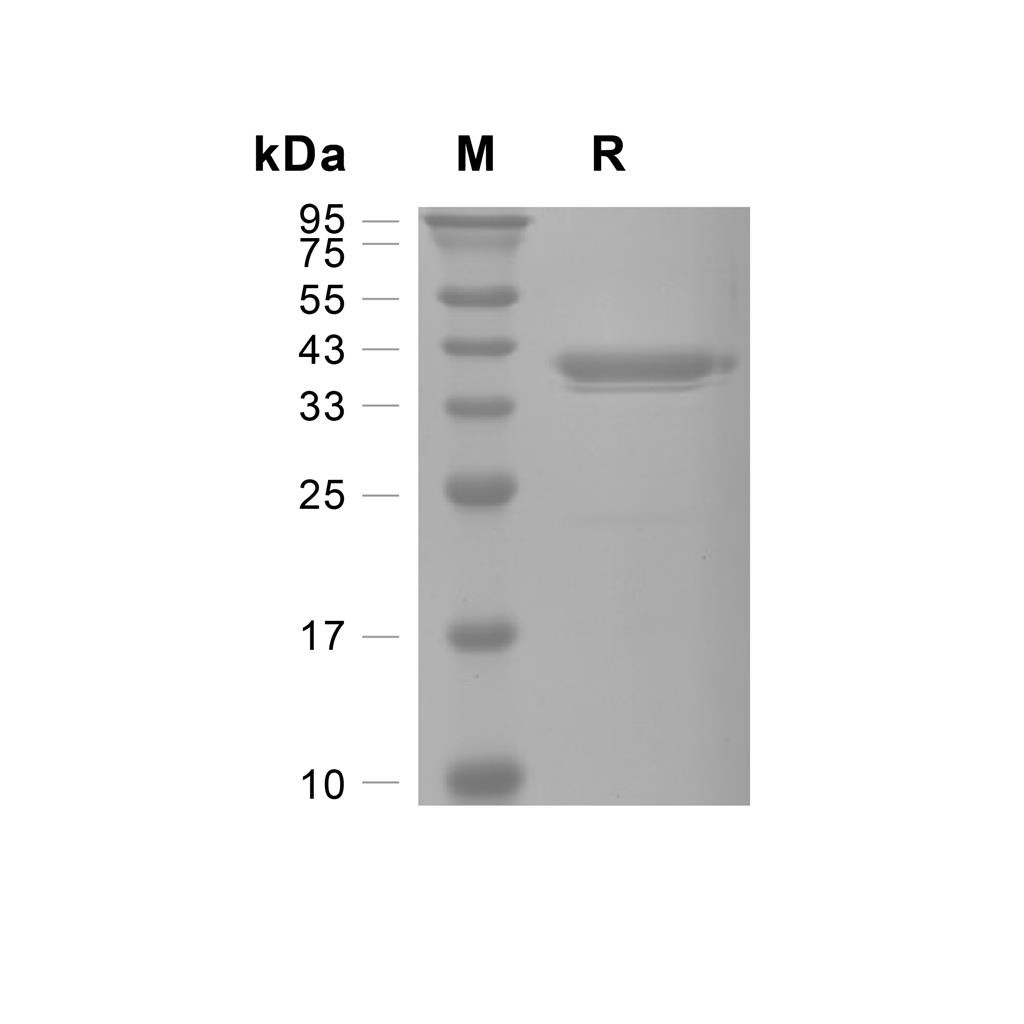 PTGR1蛋白, Human (HEK293, His),PTGR1 Protein, Human (HEK293, His)