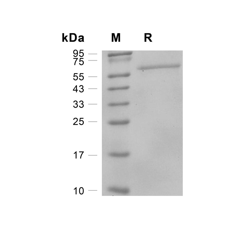 NFKBIE/IKB epsilon蛋白, Human (His),NFKBIE/IKB epsilon Protein, Human (His)