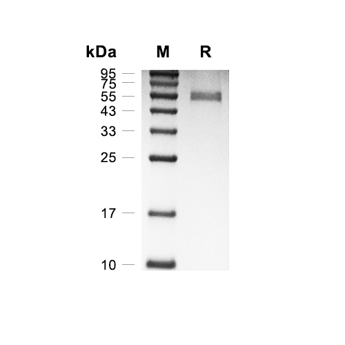 LDLRAD3蛋白, Human (HEK293, hFc),LDLRAD3 Protein, Human (HEK293, hFc)