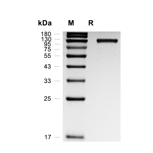 LILRB3/CD85a蛋白, Mouse (HEK293, C-His),LILRB3/CD85a Protein, Mouse (HEK293, C-His)