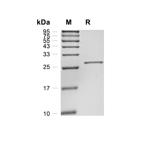Carbonic Anhydrase 1蛋白, Human (C-His),Carbonic Anhydrase 1 Protein, Human (C-His)
