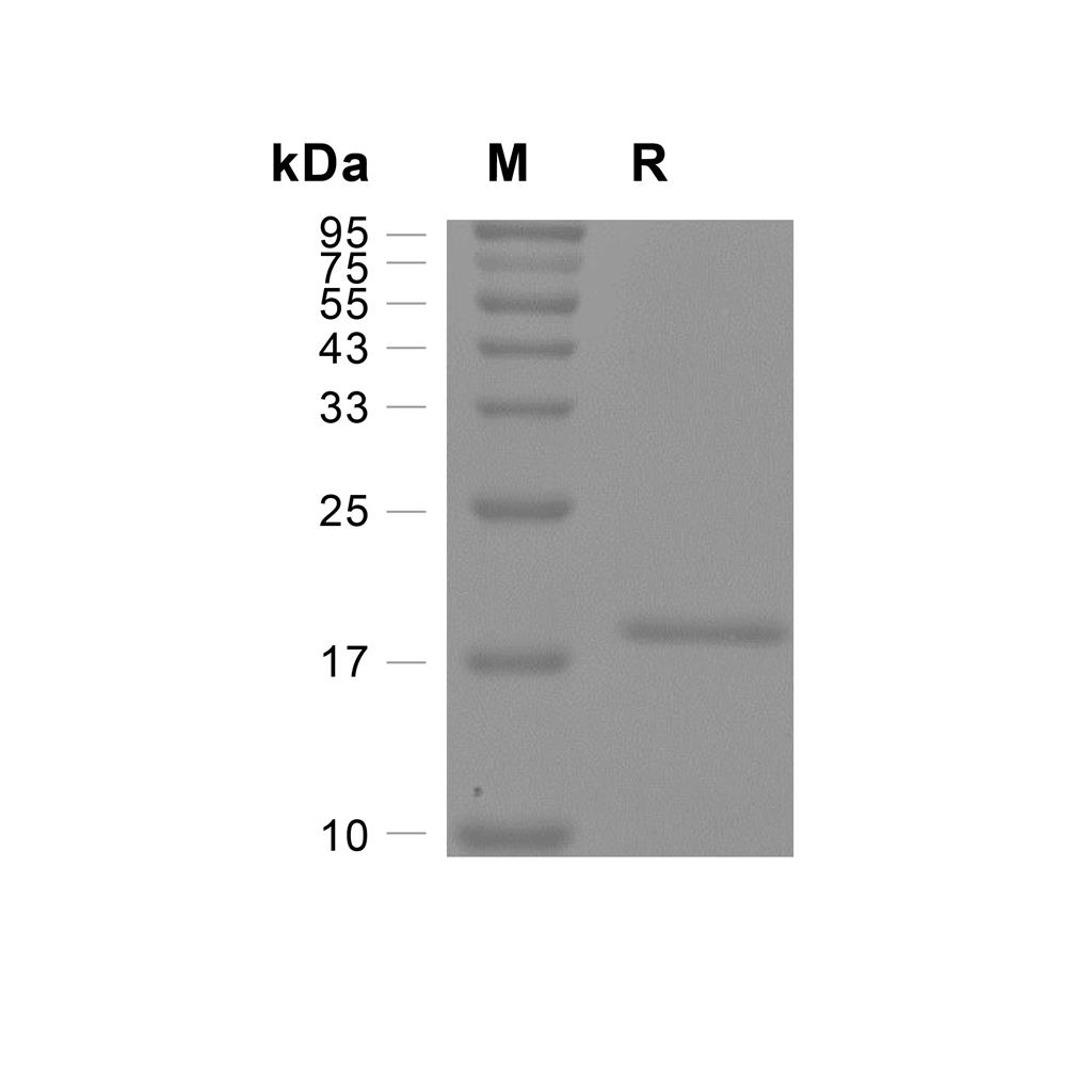 IL-1 beta蛋白, Human (C-His),IL-1 beta Protein, Human (C-His)
