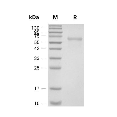 ADAM10蛋白, Human (HEK293, His),ADAM10 Protein, Human (HEK293, His)