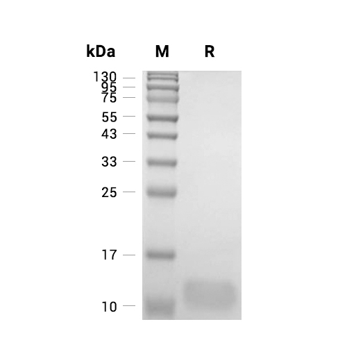 MDC/CCL22蛋白, Mouse,MDC/CCL22 Protein, Mouse