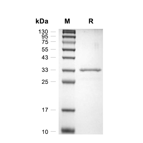 BLOC1S2蛋白, Human (N-GST),BLOC1S2 Protein, Human (N-GST)