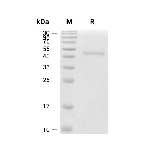 CXCR3蛋白, Human (C-His),CXCR3 Protein, Human (C-His)