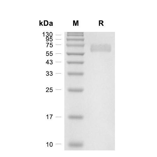 Ephrin-B2/EFNB2蛋白, Human (HEK293, His, Fc),Ephrin-B2/EFNB2 Protein, Human (HEK293, His, Fc)