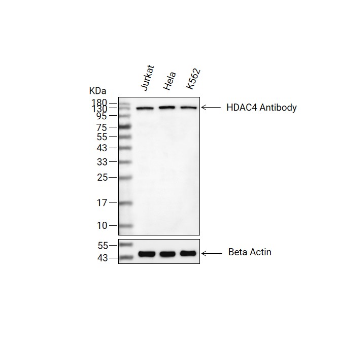 HDAC4抗体 (YA741),HDAC4 Antibody (YA741)