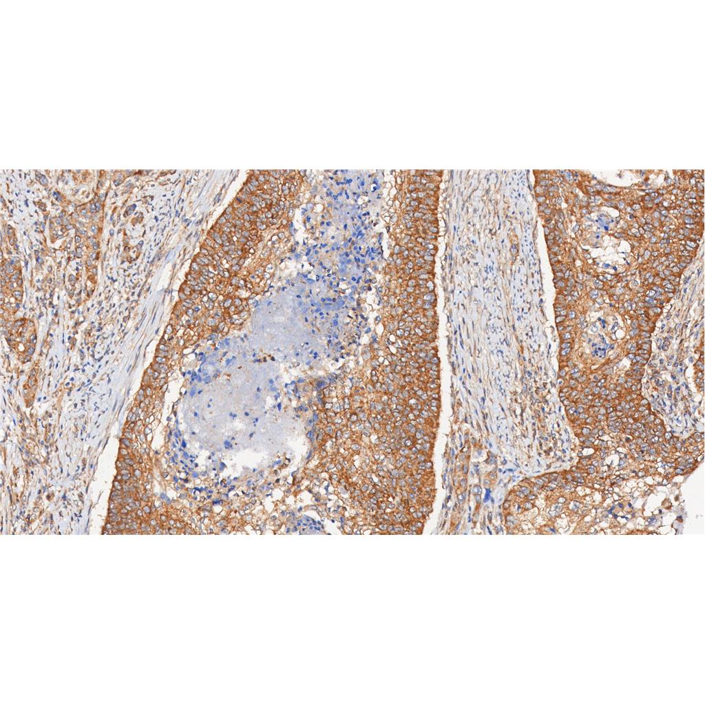 Phospho-mTOR (Ser2448)抗体 (YA171),Phospho-mTOR (Ser2448) Antibody (YA171)