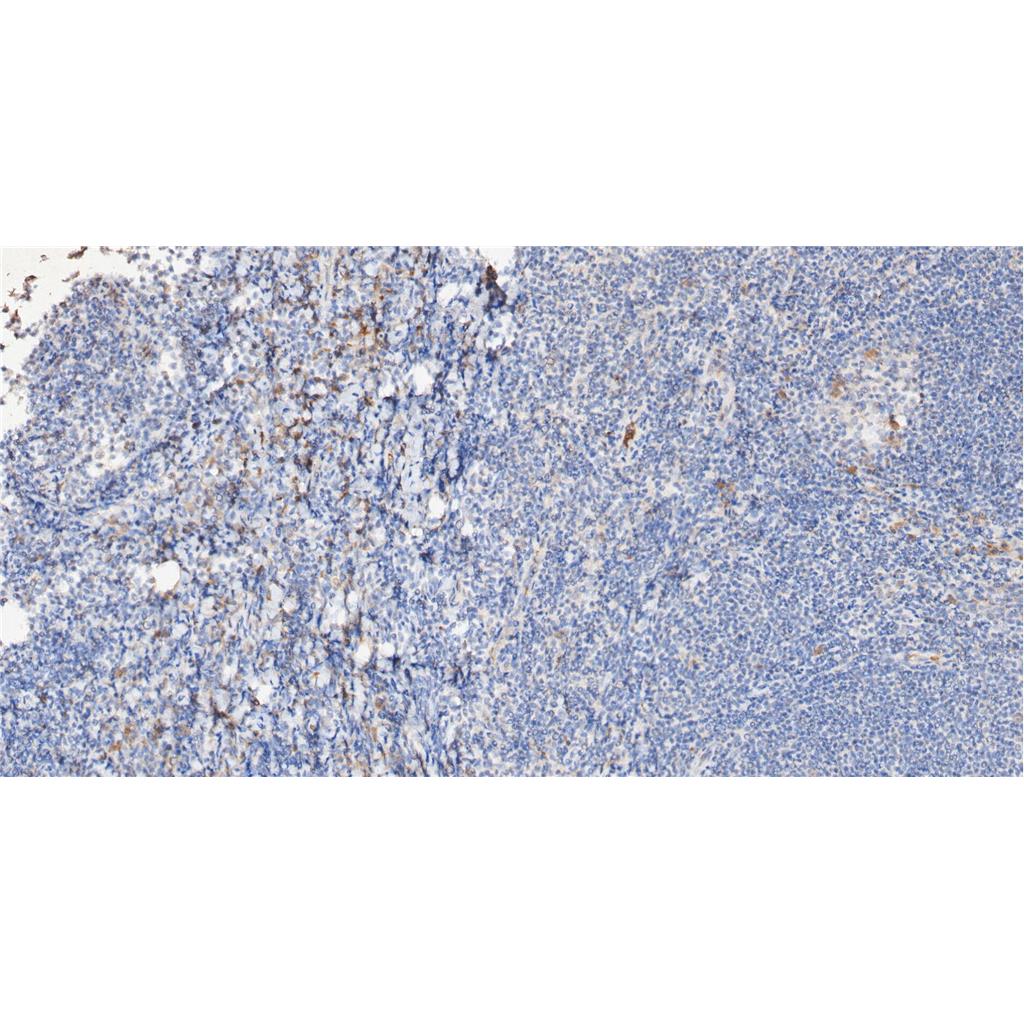 Phospho-STAT1 (Tyr701)抗体,Phospho-STAT1 (Tyr701) Antibody