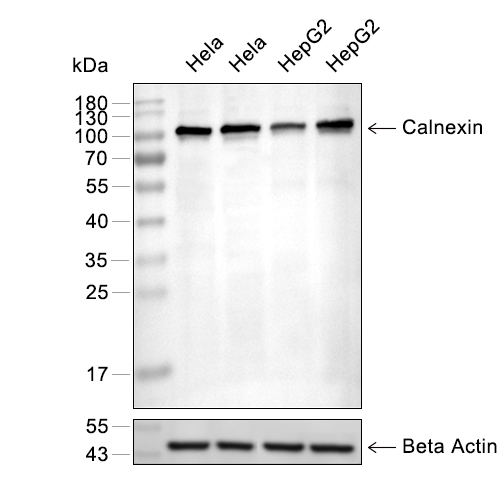 Calnexin抗体 (YA573),Calnexin Antibody (YA573)
