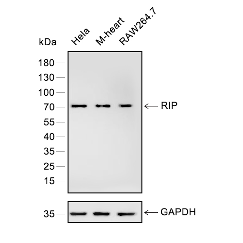 RIP抗体 (YA091),RIP Antibody (YA091)