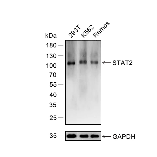 STAT2抗体 (YA057),STAT2 Antibody (YA057)