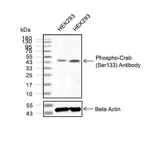Phospho-CREB (Ser133)抗体 (YA210),Phospho-CREB (Ser133) Antibody (YA210)