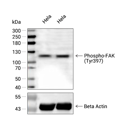 Phospho-FAK (Tyr397)抗体 (YA198),Phospho-FAK (Tyr397) Antibody (YA198)