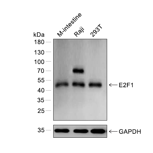 E2F-1抗体 (YA471),E2F-1 Antibody (YA471)