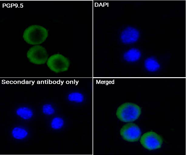 PGP9.5抗体 (YA231),PGP9.5 Antibody (YA231)