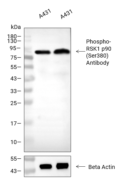 Phospho-RSK1 p90 (Ser380)抗体 (YA158),Phospho-RSK1 p90 (Ser380) Antibody (YA158)