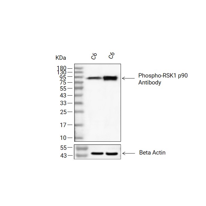 Phospho-RSK1 p90 (Thr359/Ser363)抗体 (YA157),Phospho-RSK1 p90 (Thr359/Ser363) Antibody (YA157)