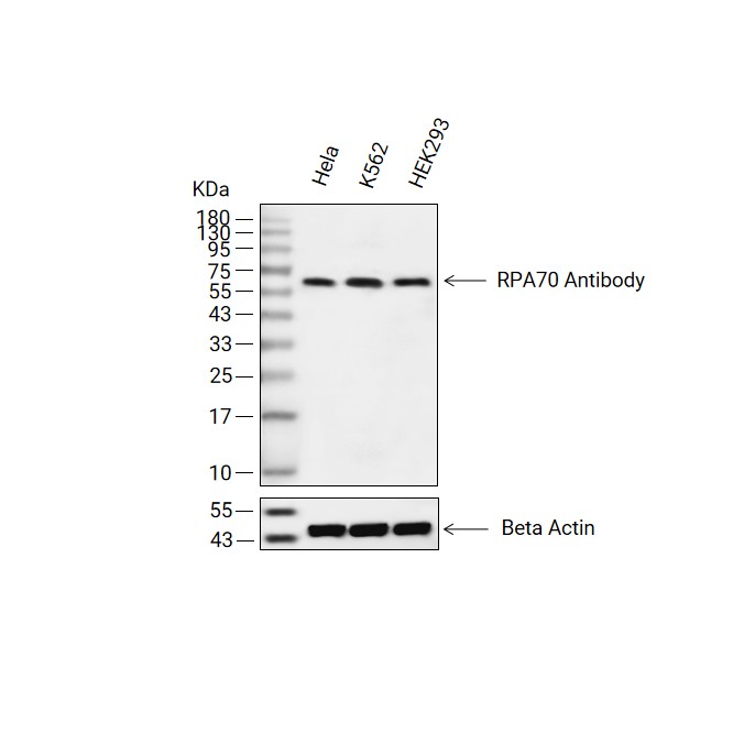 RPA70抗体 (YA678),RPA70 Antibody (YA678)