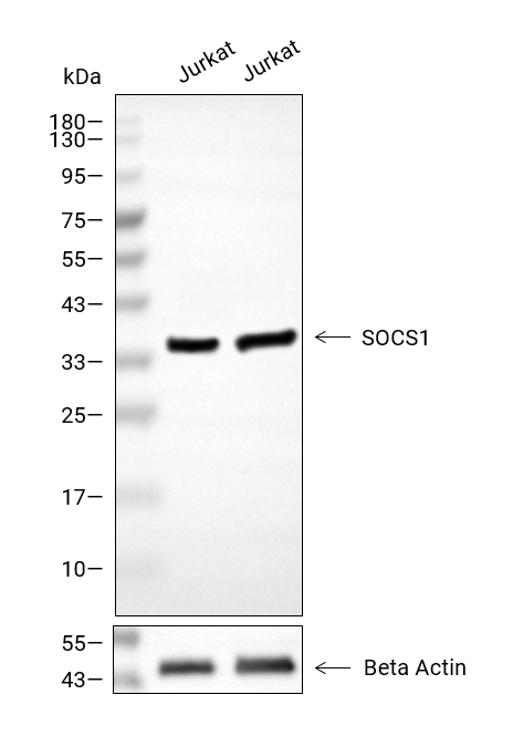 SOCS-1抗体,SOCS-1 Antibody