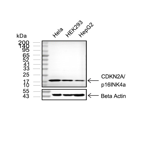 CDKN2A/p16INK4a抗体 (YA3494),CDKN2A/p16INK4a Antibody (YA3494)