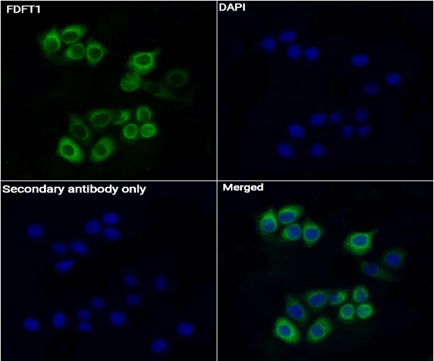 FDFT1抗体 (YA3512),FDFT1 Antibody (YA3512)
