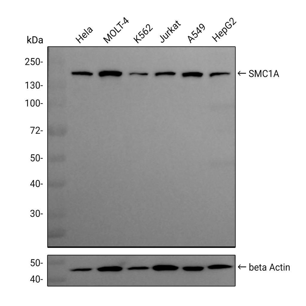 SMC1A抗体 (YA673),SMC1A Antibody (YA673)