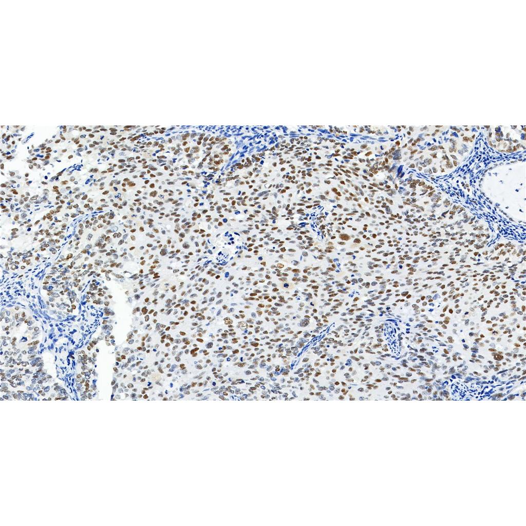 POLD1抗体 (YA1718),POLD1 Antibody (YA1718)