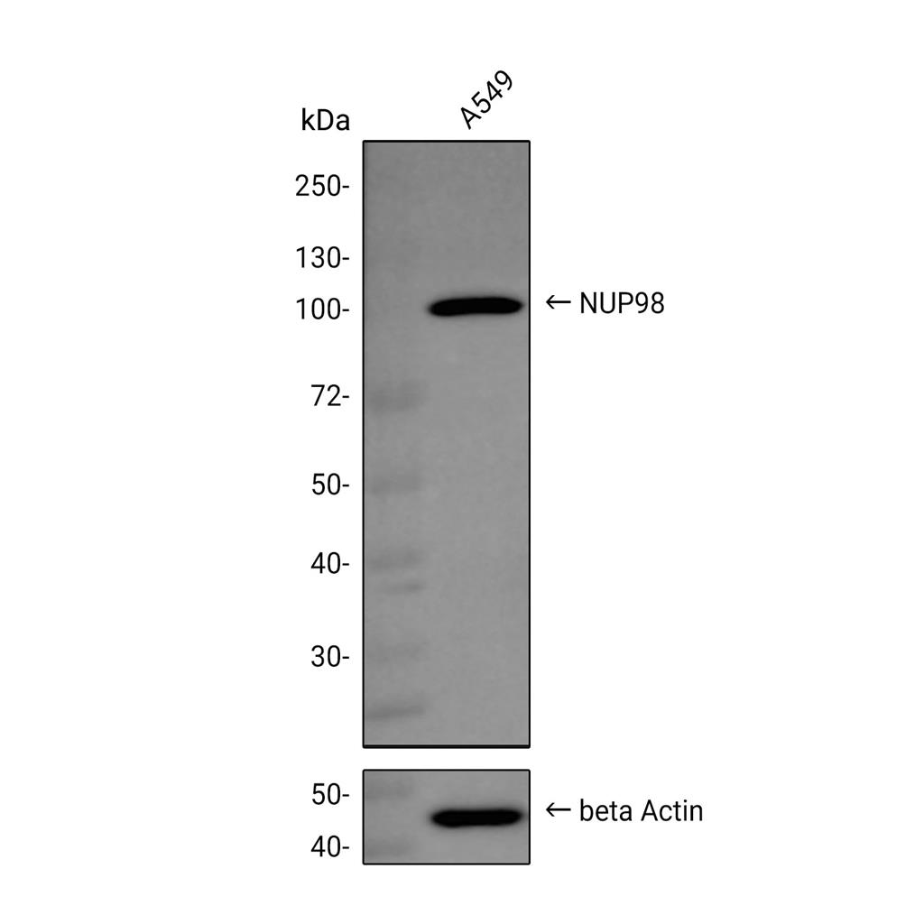 NUP98抗体 (YA1010),NUP98 Antibody (YA1010)