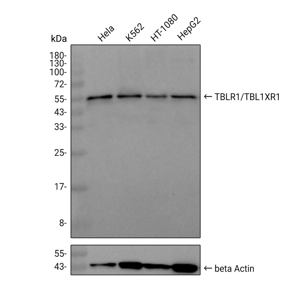 TBLR1抗体 (YA1052),TBLR1 Antibody (YA1052)