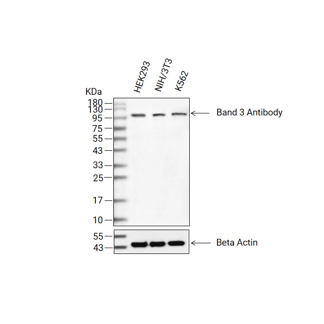Band 3抗体 (YA1819),Band 3 Antibody (YA1819)