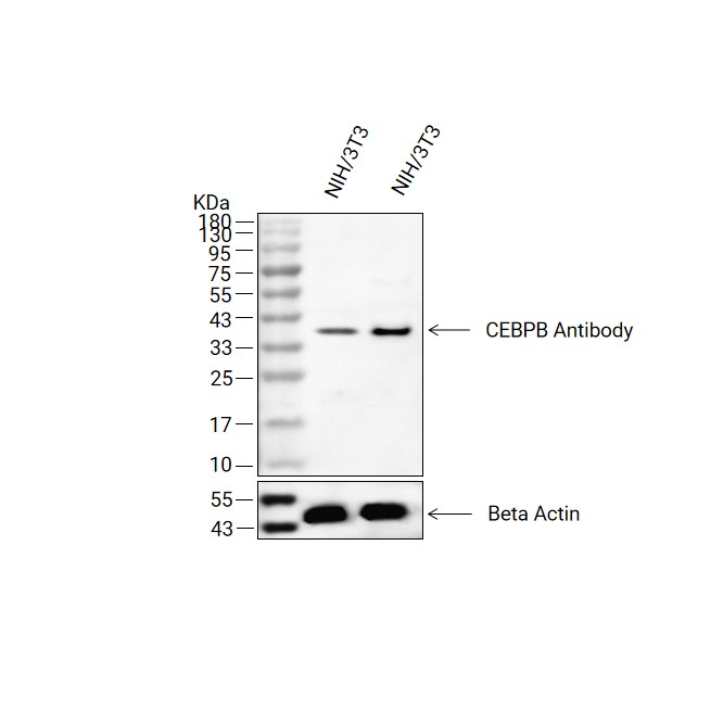 CEBP beta抗体 (YA1835),CEBP beta Antibody (YA1835)