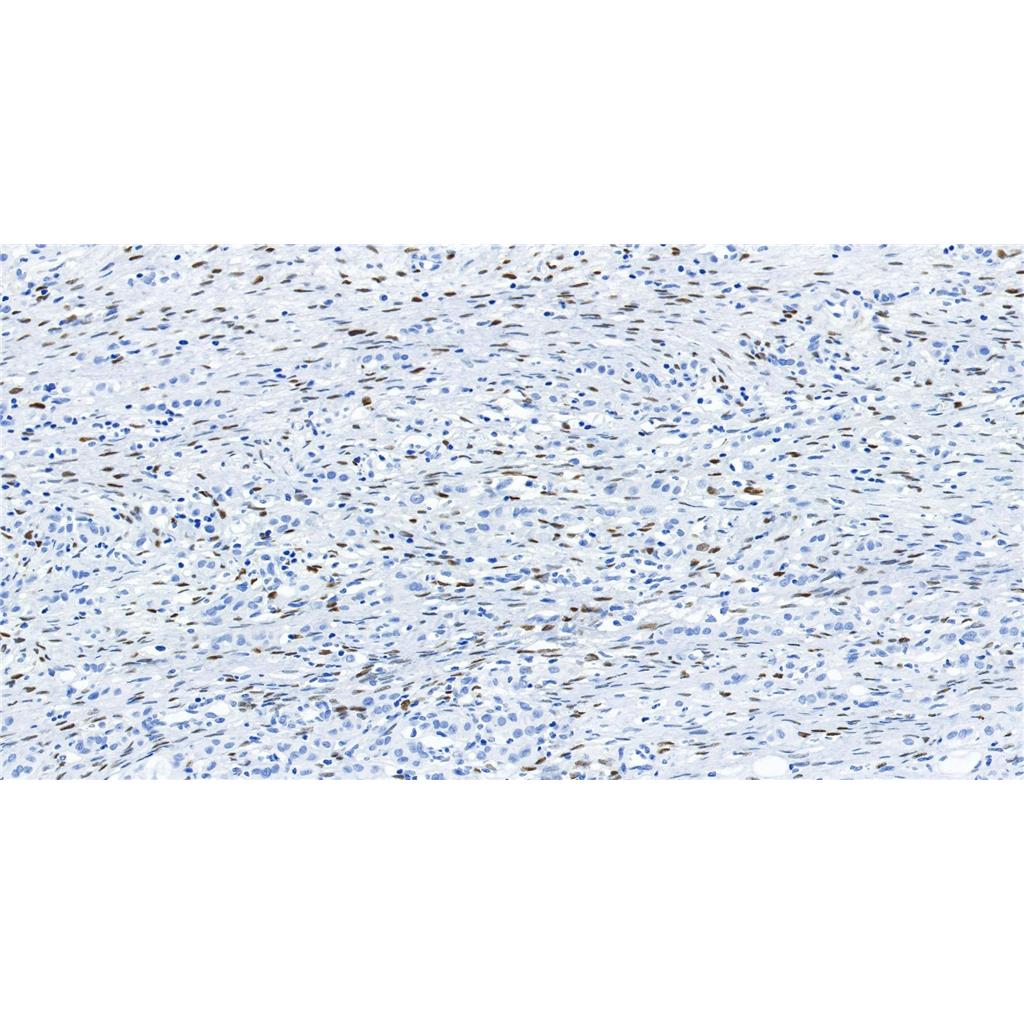 Progesterone Receptor抗体 (YA1866),Progesterone Receptor Antibody (YA1866)