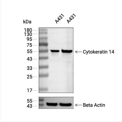 Cytokeratin 14抗体 (YA1876),Cytokeratin 14 Antibody (YA1876)