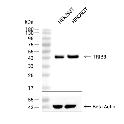 TRIB3抗体 (YA2174),TRIB3 Antibody (YA2174)