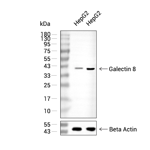 Galectin 8抗体 (YA2186),Galectin 8 Antibody (YA2186)