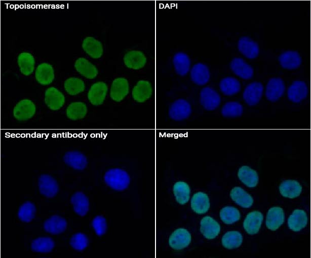 Topoisomerase I抗体 (YA2237),Topoisomerase I Antibody (YA2237)