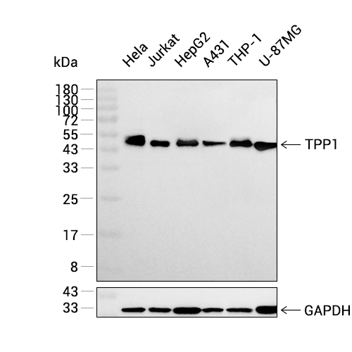 TPP1抗体 (YA2244),TPP1 Antibody (YA2244)