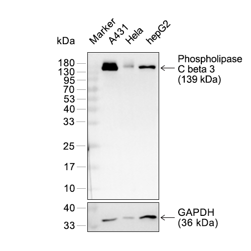 Phospholipase C beta 3抗体 (YA2694),Phospholipase C beta 3 Antibody (YA2694)