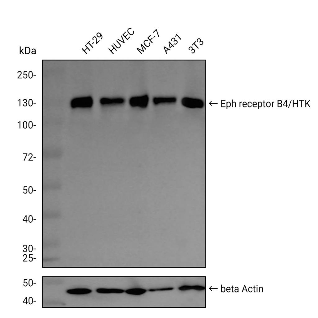 Ephrin Receptor B4抗体 (YA2892),Ephrin Receptor B4 Antibody (YA2892)