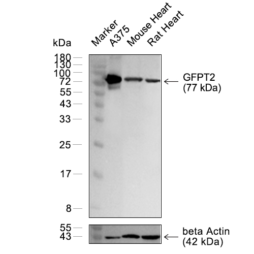 GFPT2抗体 (YA2914),GFPT2 Antibody (YA2914)