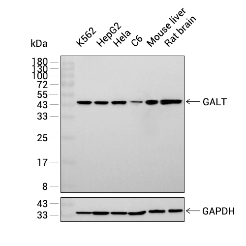 GALT抗体 (YA2925),GALT Antibody (YA2925)