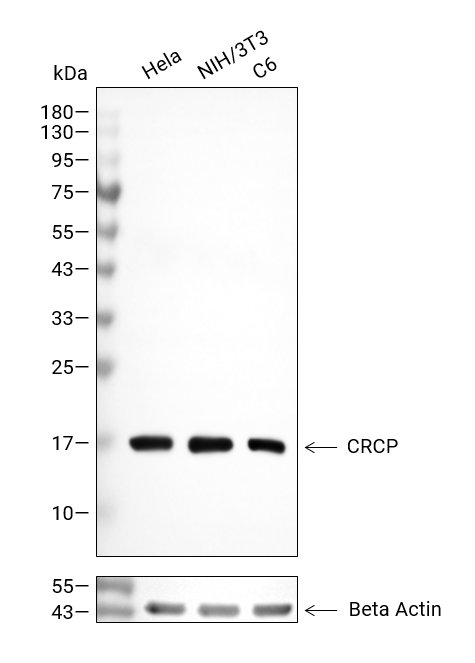 CRCP抗体 (YA3350),CRCP Antibody (YA3350)