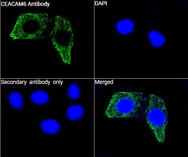 CEACAM6抗体 (YA3351),CEACAM6 Antibody (YA3351)