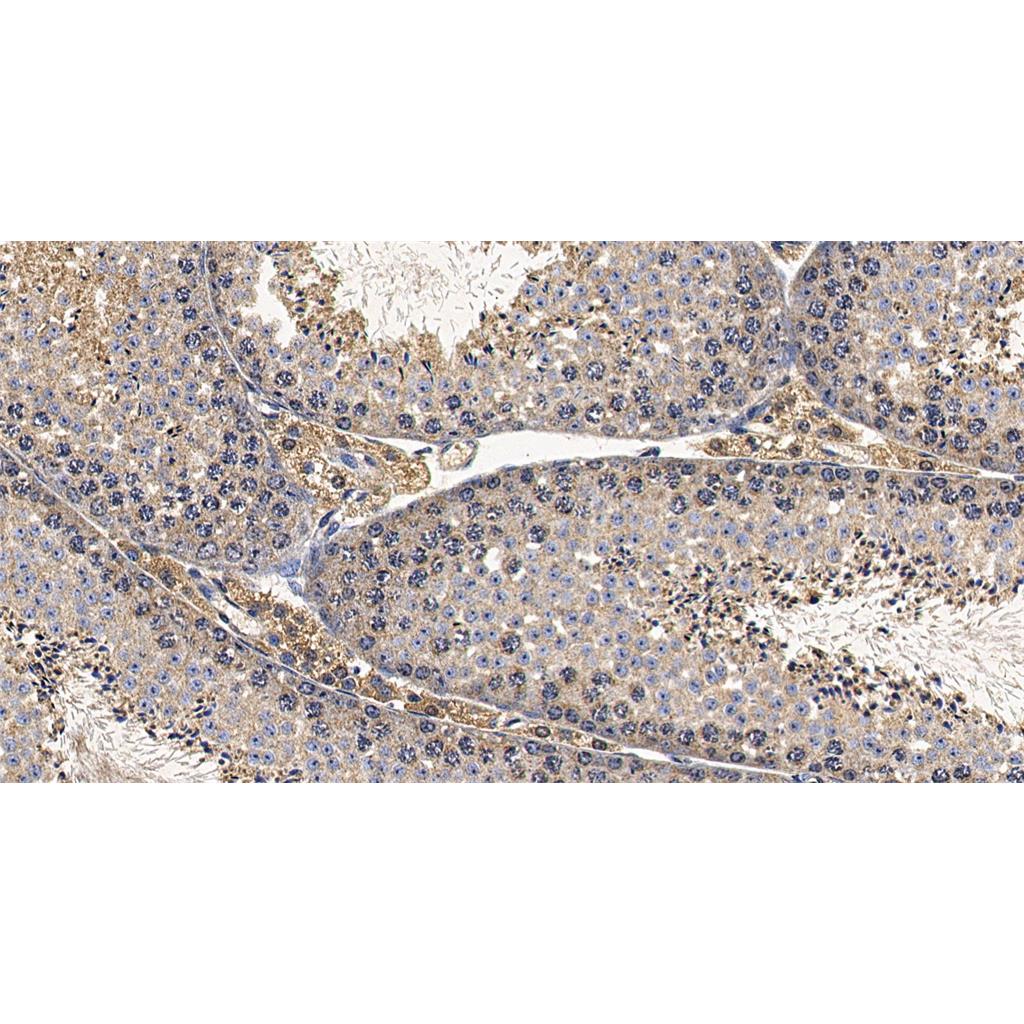 ALKBH5抗体 (YA3429),ALKBH5 Antibody (YA3429)